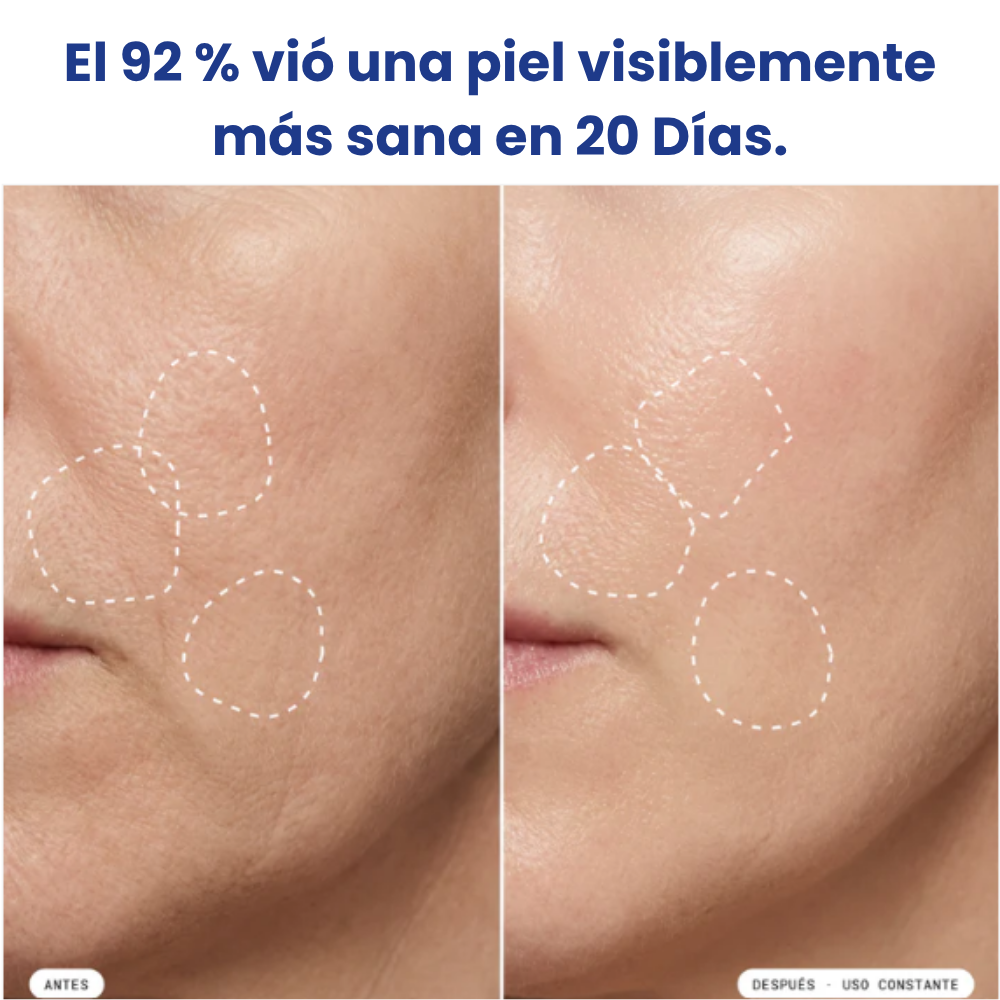 Crema Correctora de Tono con Niacinamida